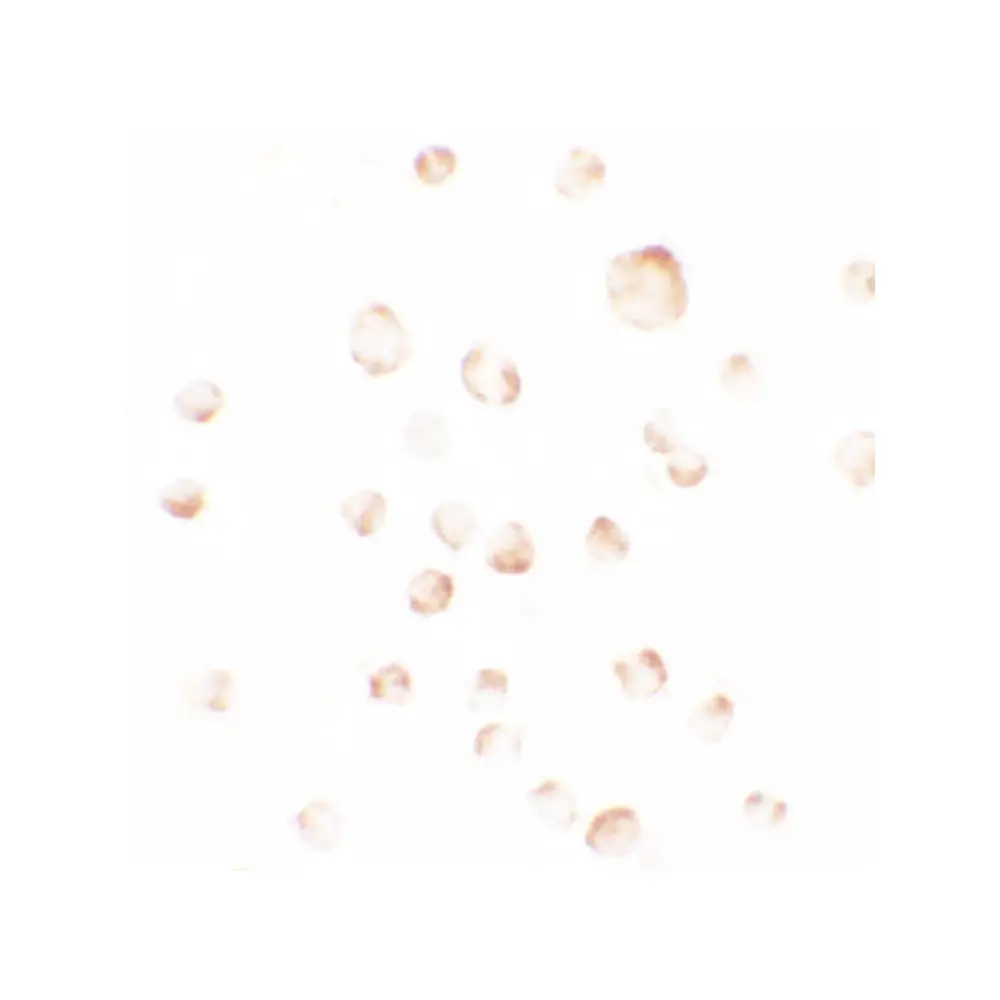 ProSci 7019_S PHLPP1 Antibody, ProSci, 0.02 mg/Unit Secondary Image