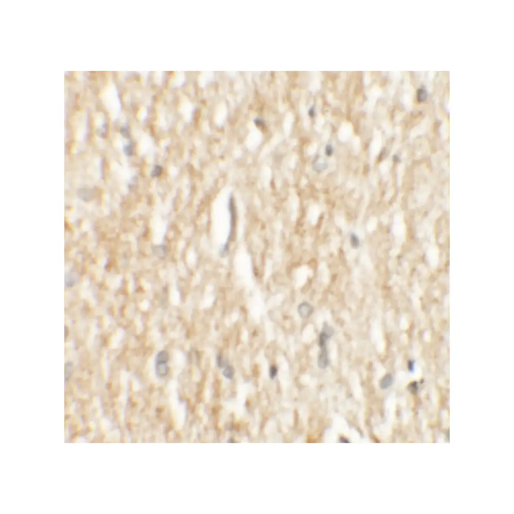 ProSci 6827 PHOX2A Antibody, ProSci, 0.1 mg/Unit Secondary Image