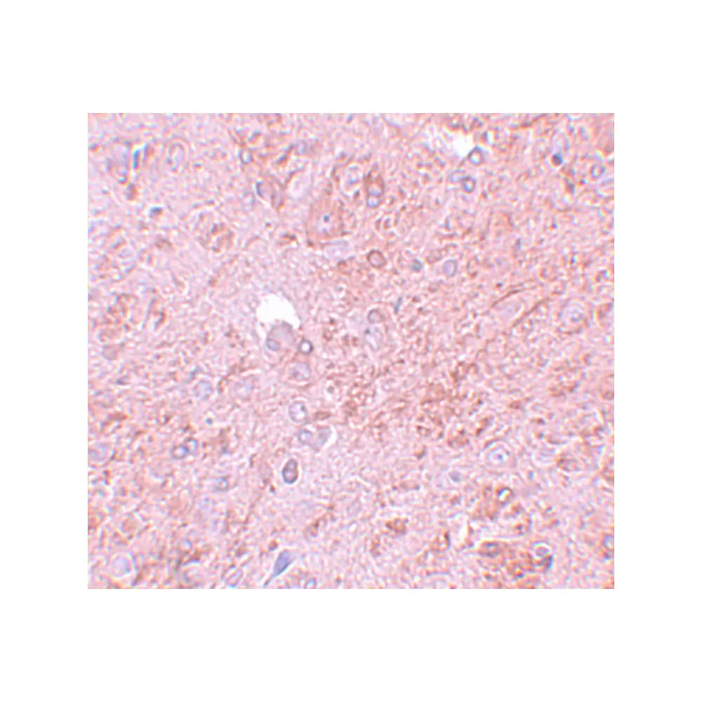 ProSci 5747 PIAS4 Antibody, ProSci, 0.1 mg/Unit Secondary Image