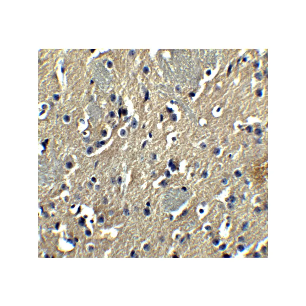 ProSci 6161 PION Antibody, ProSci, 0.1 mg/Unit Quaternary Image