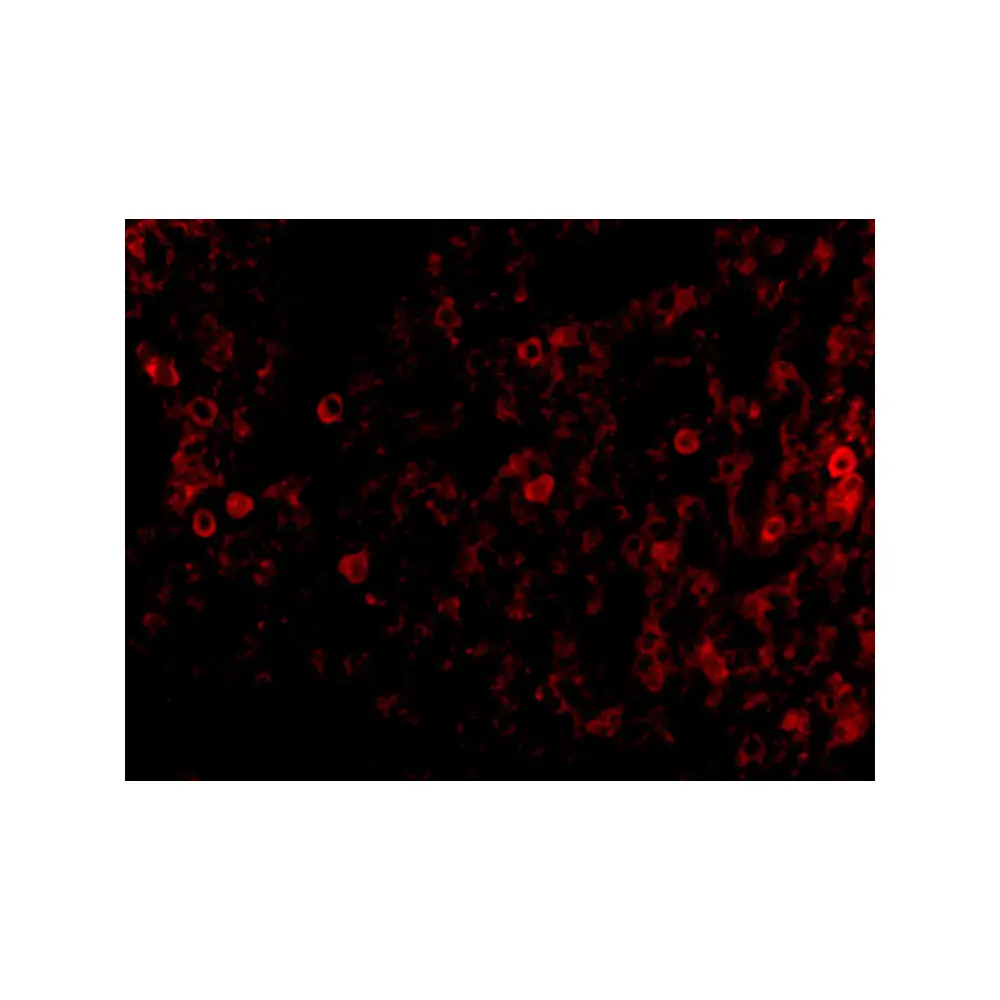 ProSci 3947 PKR Antibody, ProSci, 0.1 mg/Unit Tertiary Image