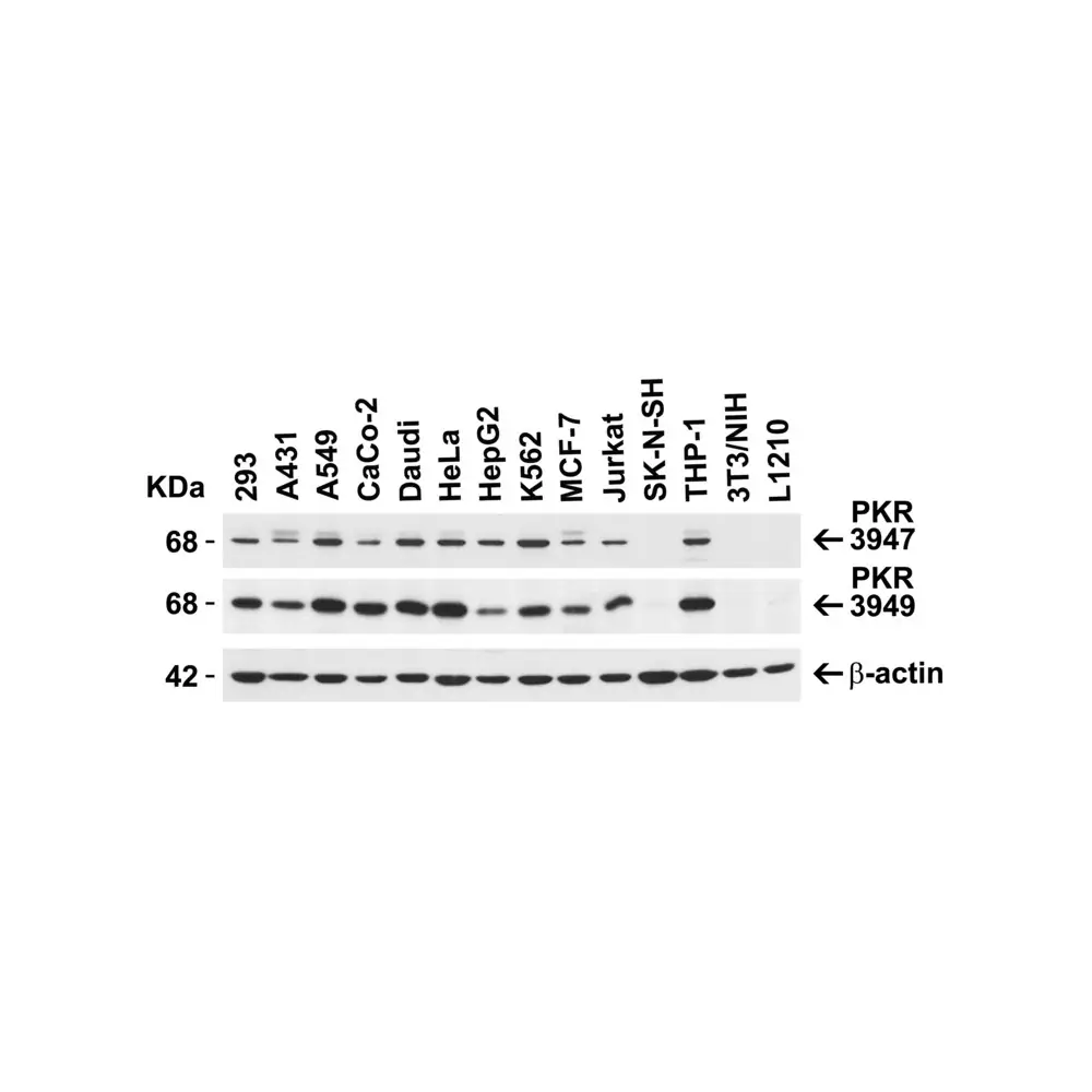 ProSci 3947 PKR Antibody, ProSci, 0.1 mg/Unit Secondary Image