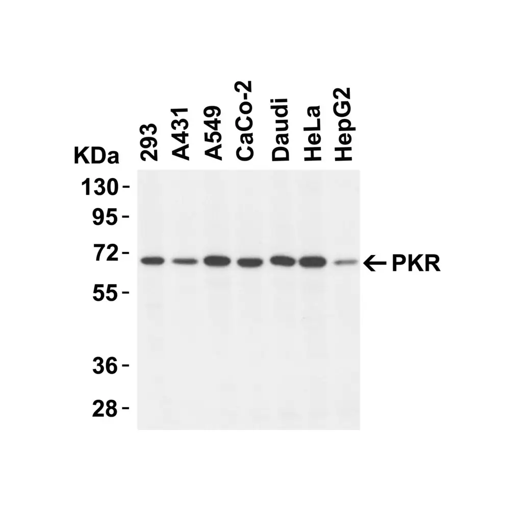 ProSci 3949_S PKR Antibody, ProSci, 0.02 mg/Unit Tertiary Image