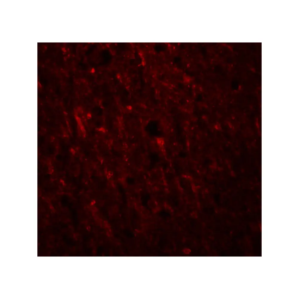ProSci 5485 PLEKHM2 Antibody, ProSci, 0.1 mg/Unit Tertiary Image