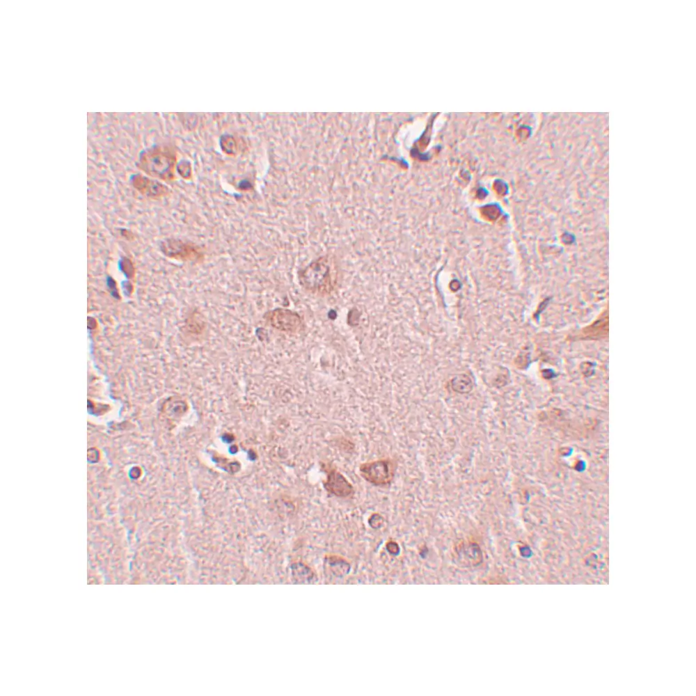 ProSci 5485 PLEKHM2 Antibody, ProSci, 0.1 mg/Unit Secondary Image
