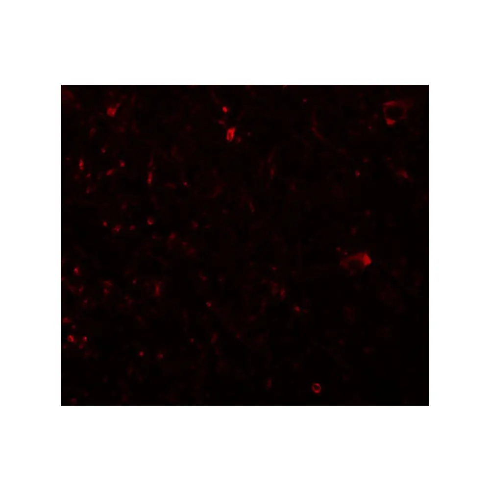 ProSci 5487 PLEKHM3 Antibody, ProSci, 0.1 mg/Unit Tertiary Image