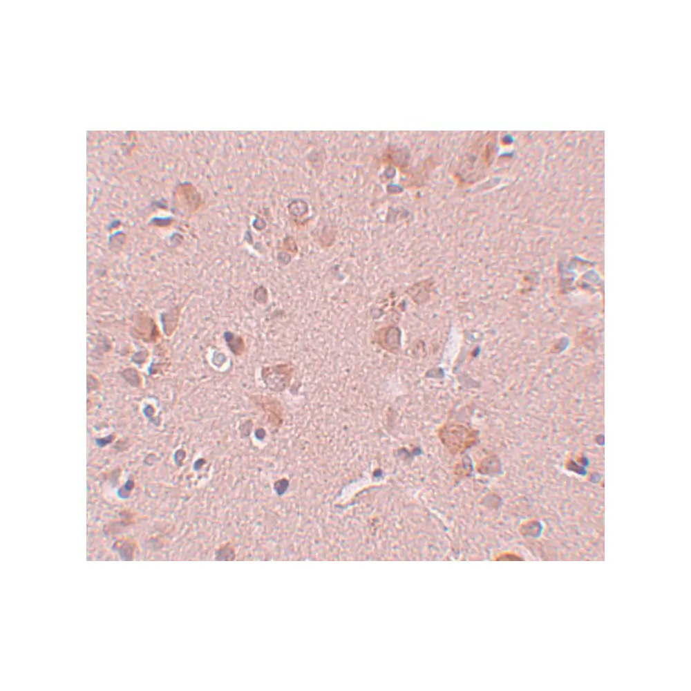 ProSci 5487 PLEKHM3 Antibody, ProSci, 0.1 mg/Unit Secondary Image