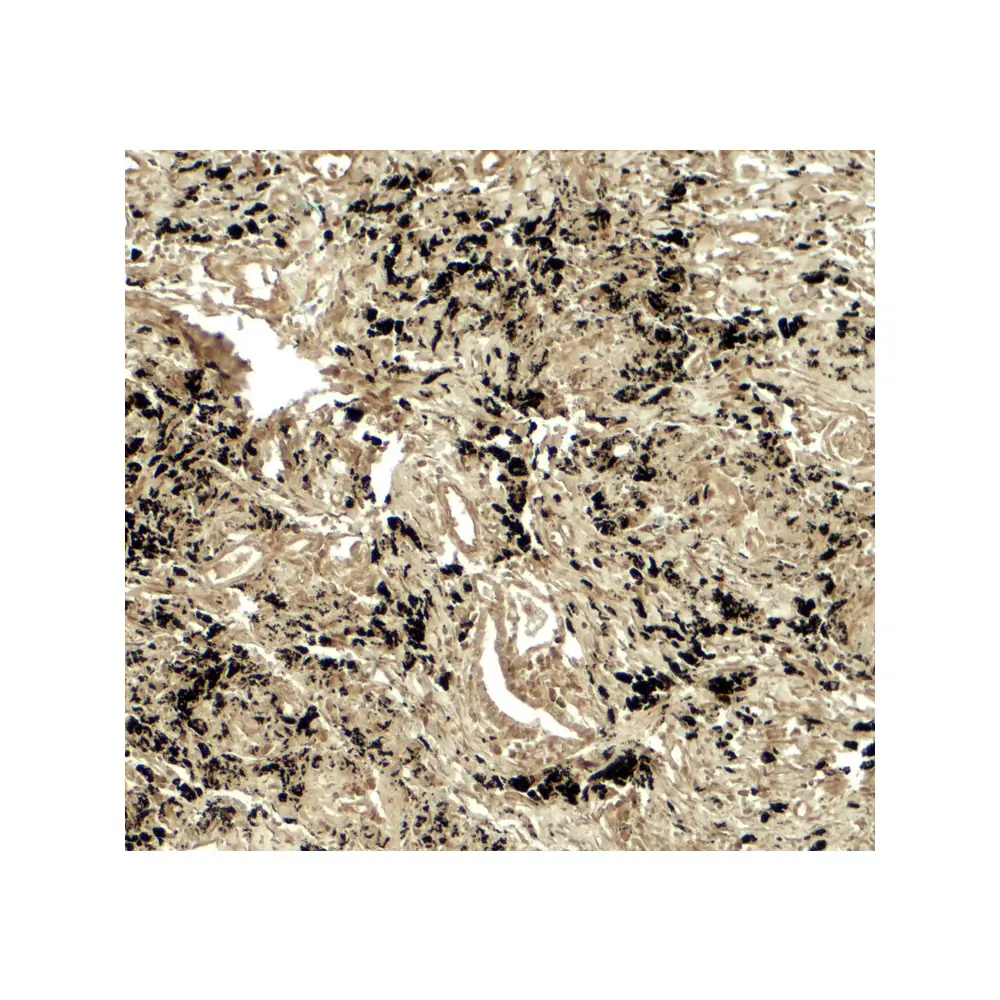 ProSci 8043 PPM1D Antibody, ProSci, 0.1 mg/Unit Secondary Image