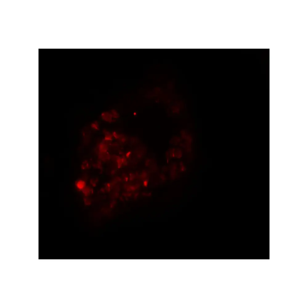 ProSci 6561 PRICKLE1 Antibody, ProSci, 0.1 mg/Unit Secondary Image