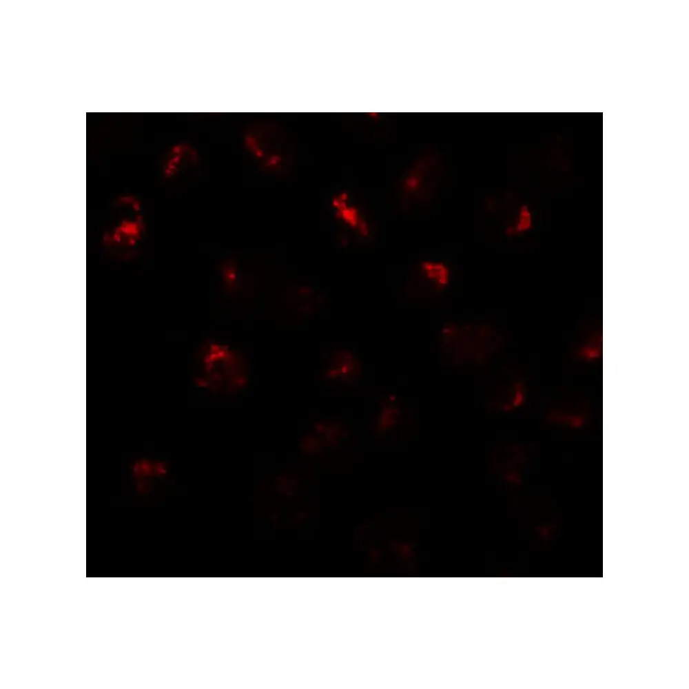 ProSci 6293 PRR5L Antibody, ProSci, 0.1 mg/Unit Tertiary Image