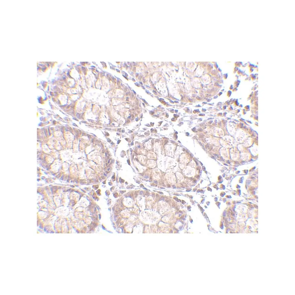 ProSci 4299 PTK7 Antibody, ProSci, 0.1 mg/Unit Secondary Image