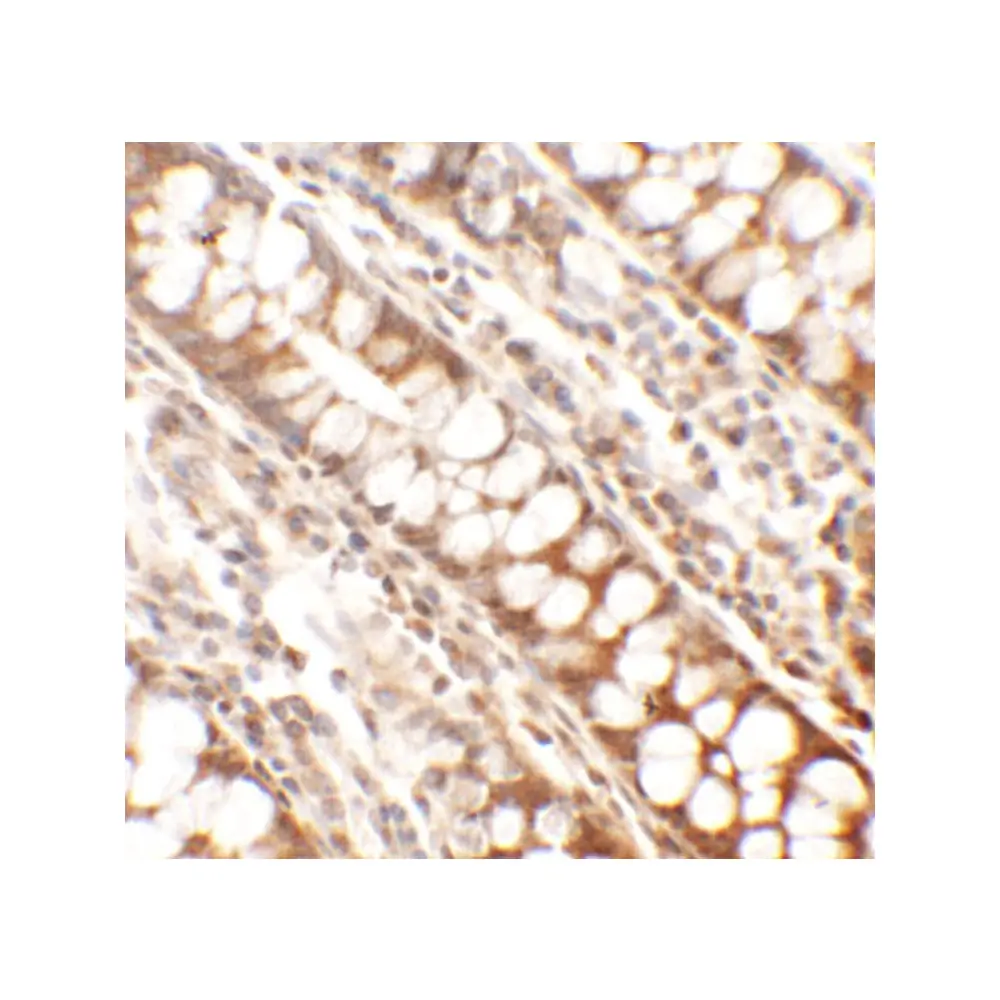 ProSci 6687_S Periphilin Antibody, ProSci, 0.02 mg/Unit Secondary Image