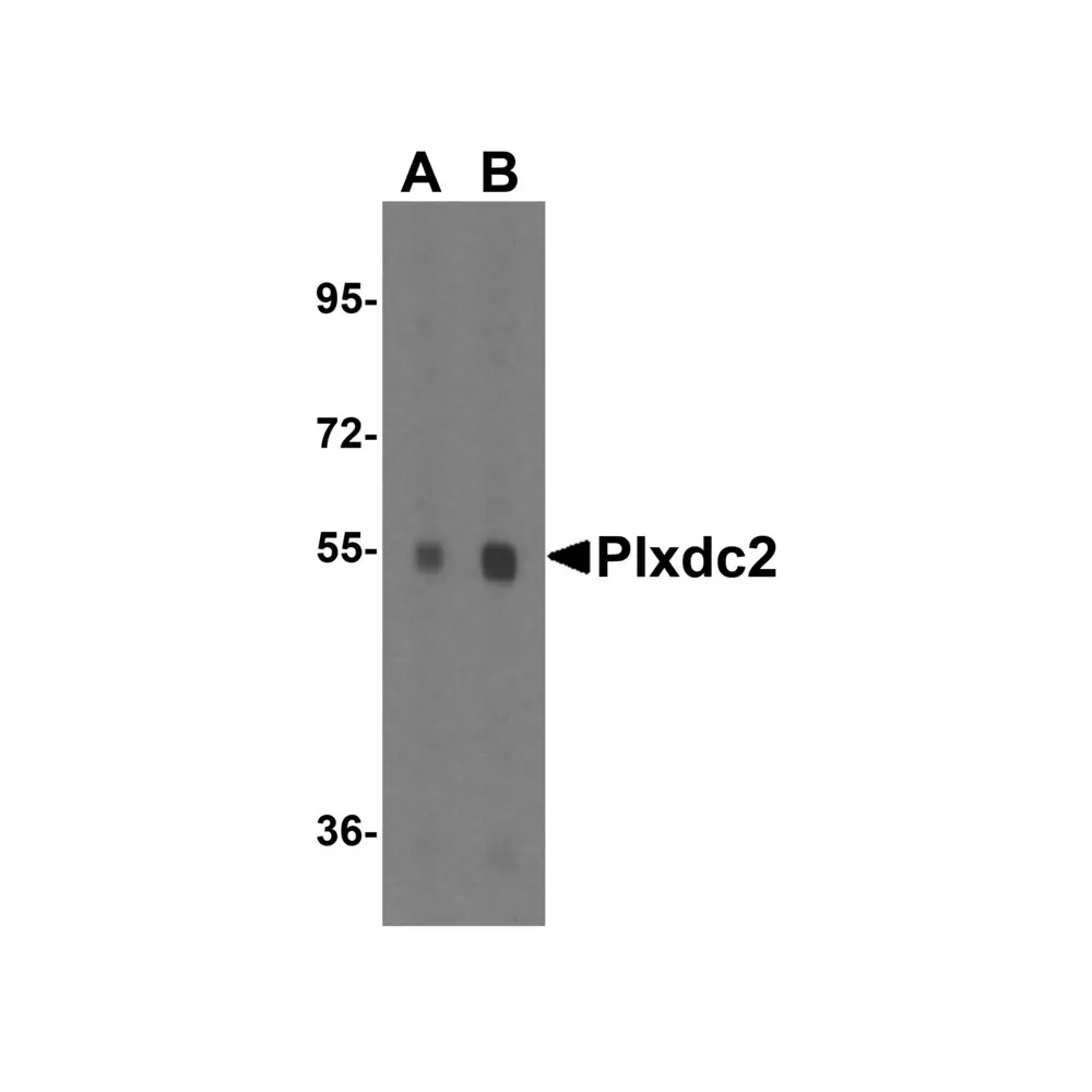 ProSci 4417_S Plxdc2 Antibody, ProSci, 0.02 mg/Unit Quaternary Image