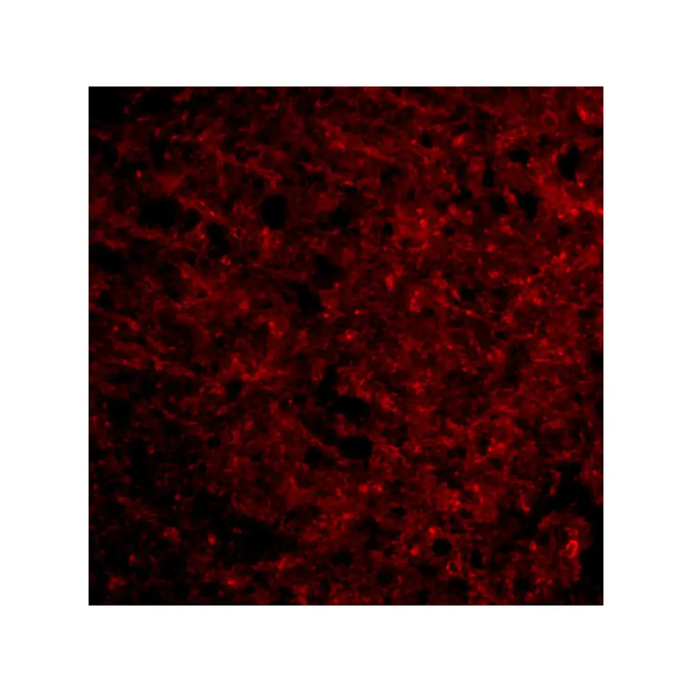 ProSci 4203_S Presenilin1 Antibody, ProSci, 0.02 mg/Unit Tertiary Image