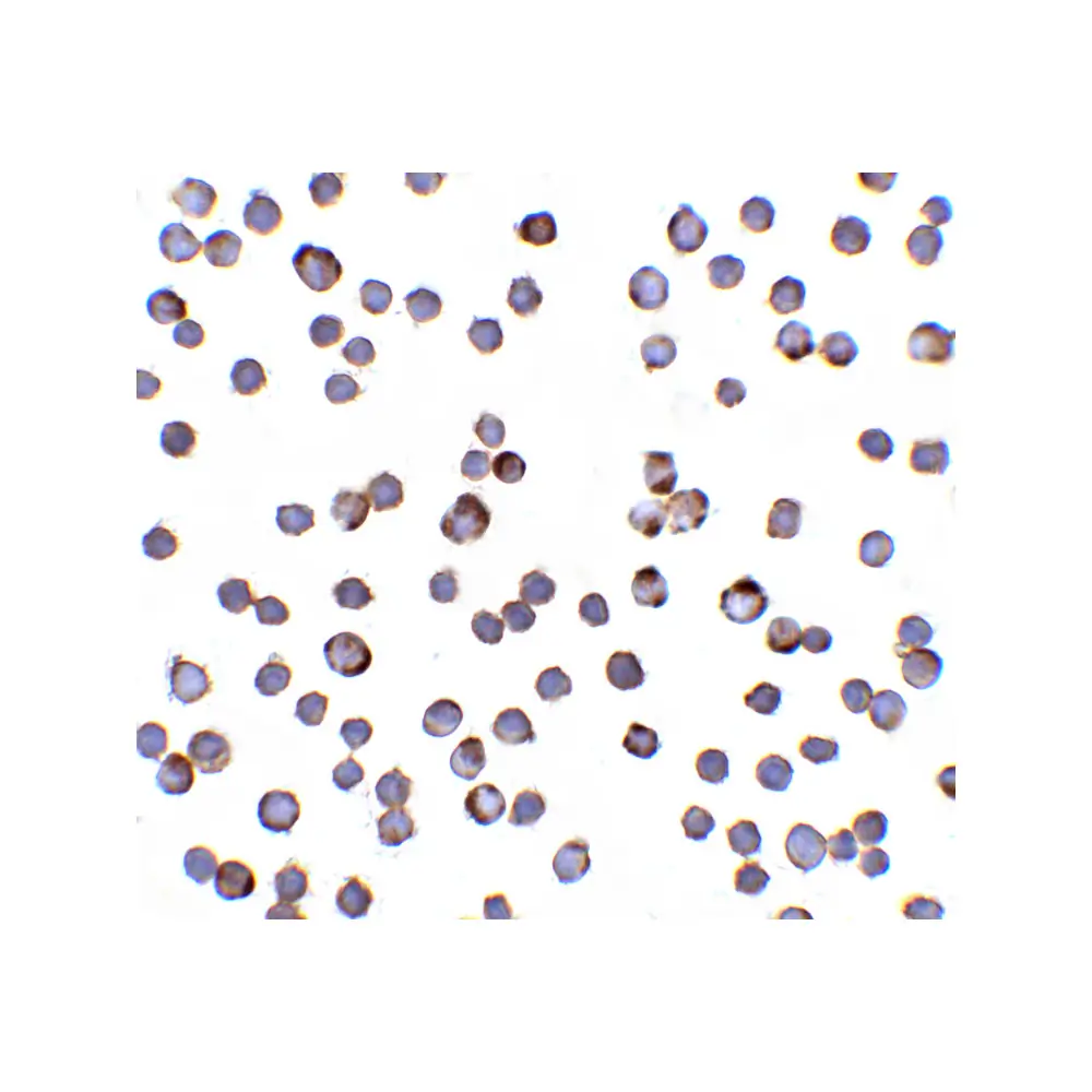 ProSci 1117_S RAIDD Antibody, ProSci, 0.02 mg/Unit Quaternary Image