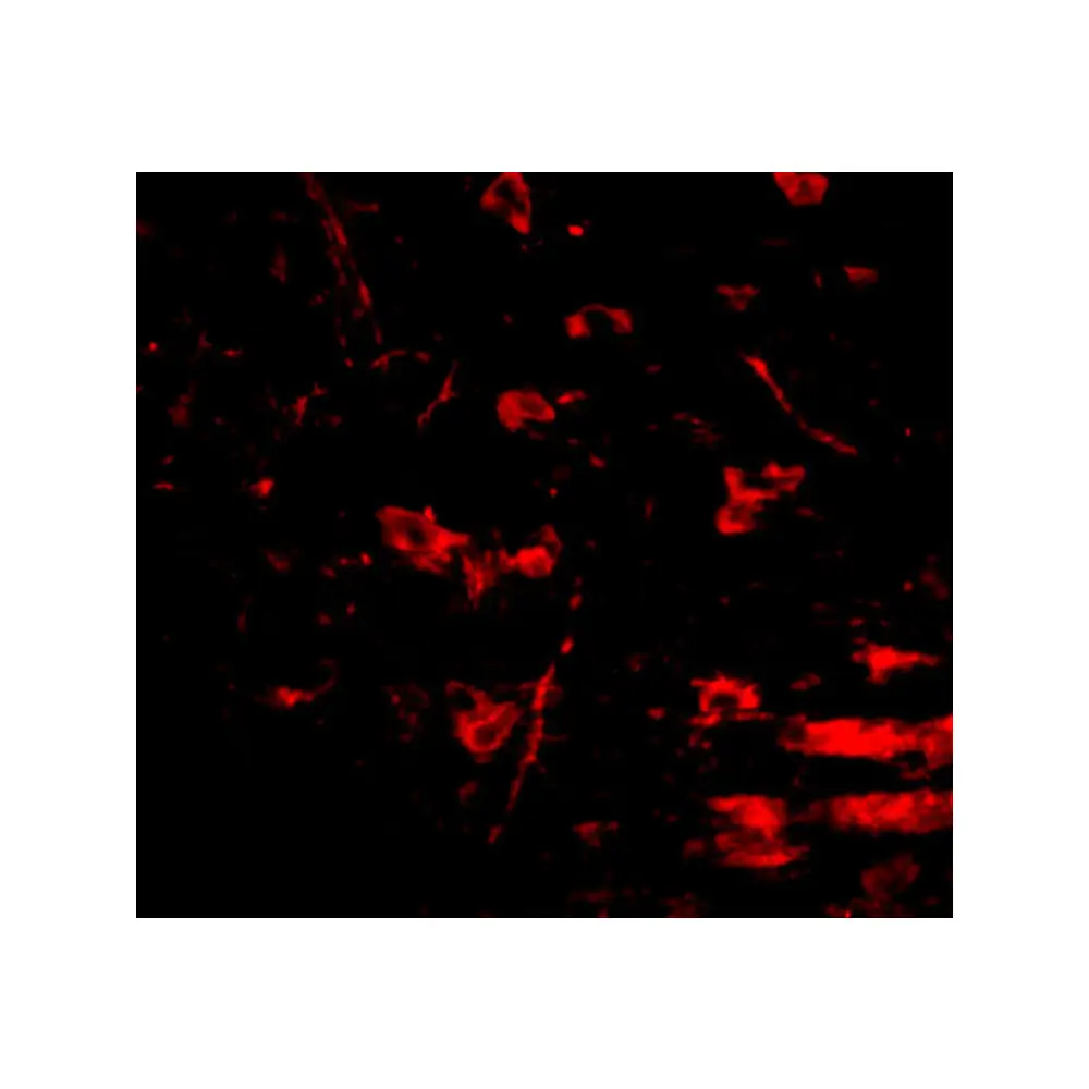 ProSci 5051 RCAN2 Antibody, ProSci, 0.1 mg/Unit Tertiary Image