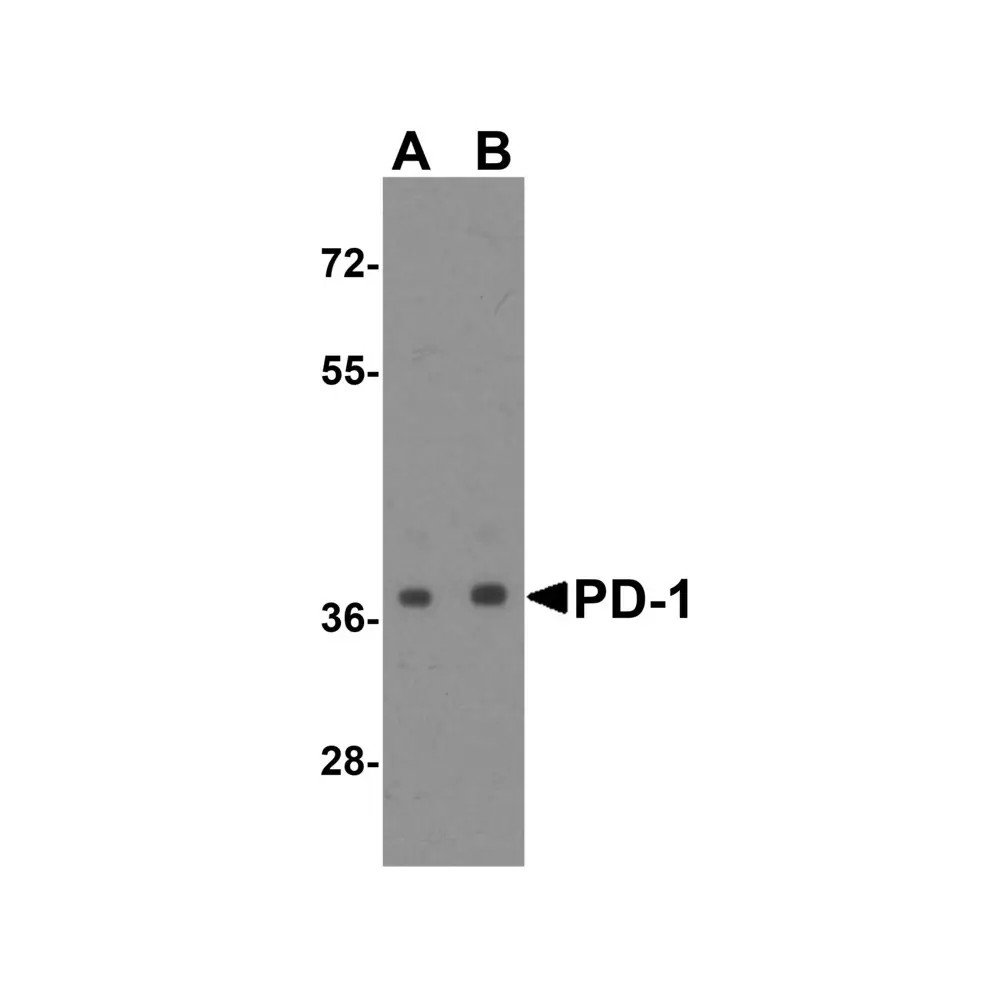 ProSci RF16002 PD1 Antibody [8A4], ProSci, 0.1 mg/Unit Primary Image