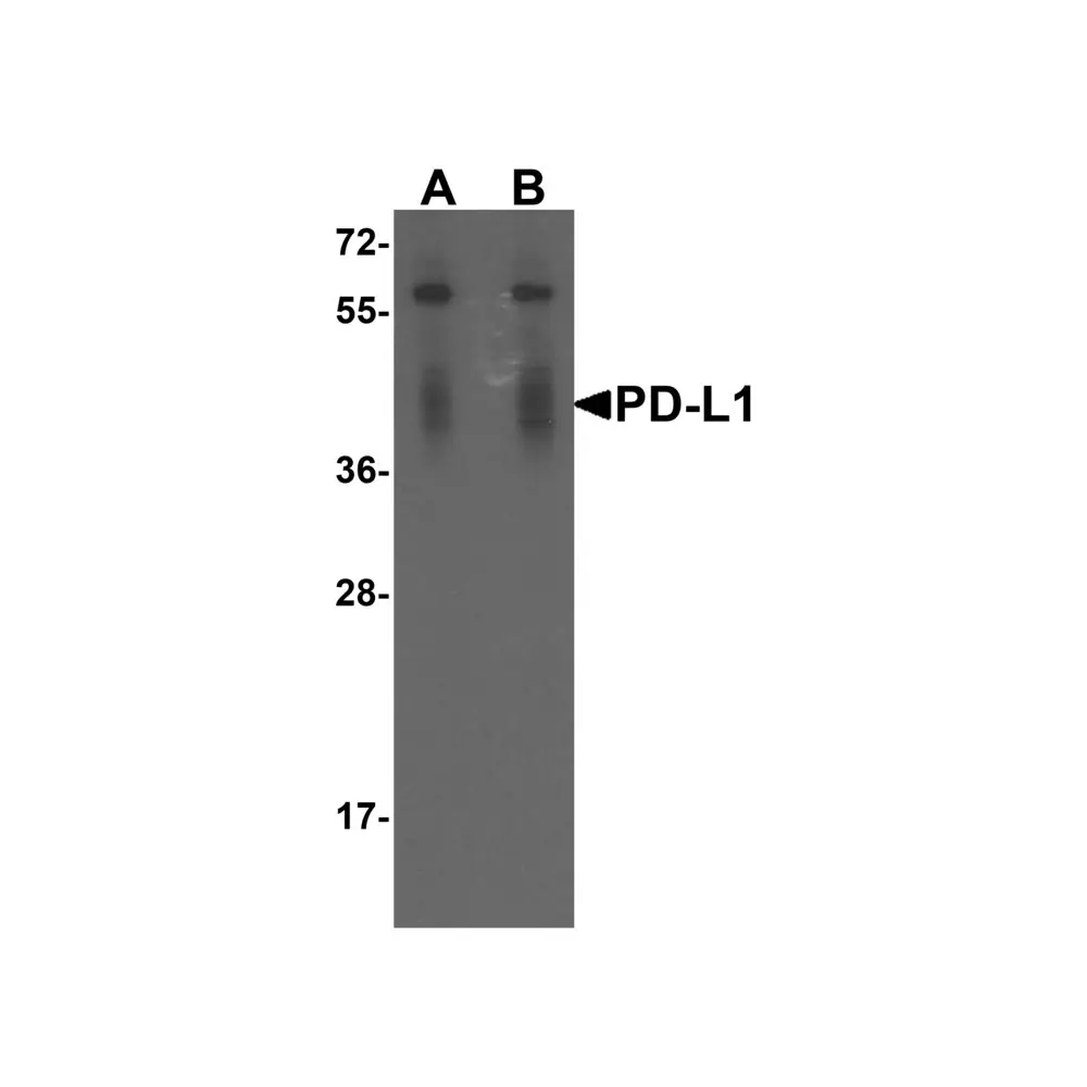 ProSci RF16037_S PDL1 Antibody [1F11], ProSci, 0.02 mg/Unit Primary Image