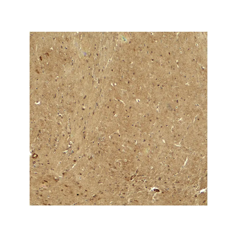 ProSci 8027 RHOT1 Antibody, ProSci, 0.1 mg/Unit Secondary Image