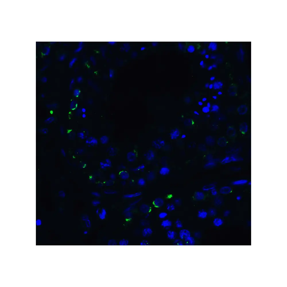ProSci 3953 RIG-1 Antibody, ProSci, 0.1 mg/Unit Quaternary Image