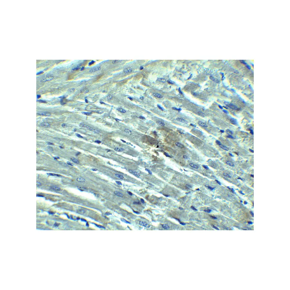 ProSci 3953 RIG-1 Antibody, ProSci, 0.1 mg/Unit Tertiary Image