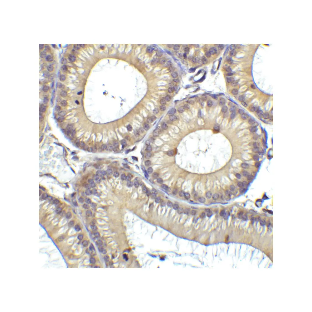 ProSci 3953 RIG-1 Antibody, ProSci, 0.1 mg/Unit Secondary Image