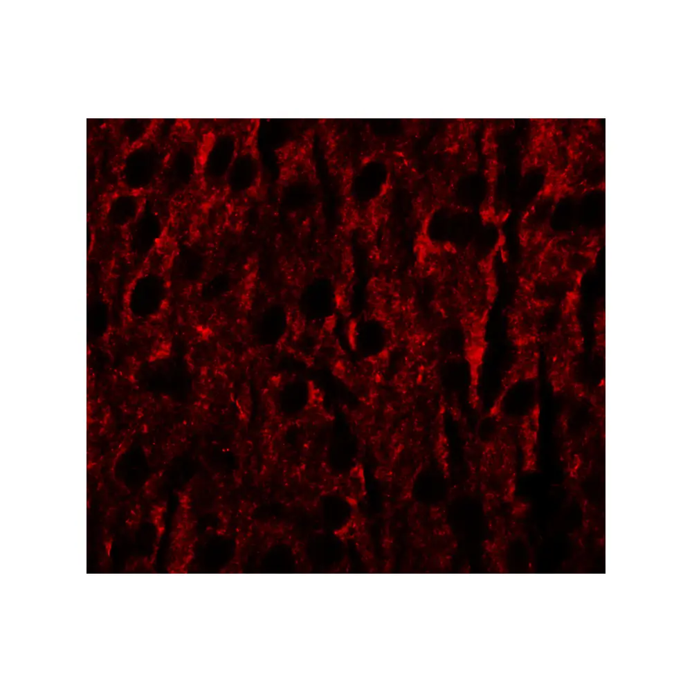 ProSci 6495 RILPL1 Antibody, ProSci, 0.1 mg/Unit Secondary Image