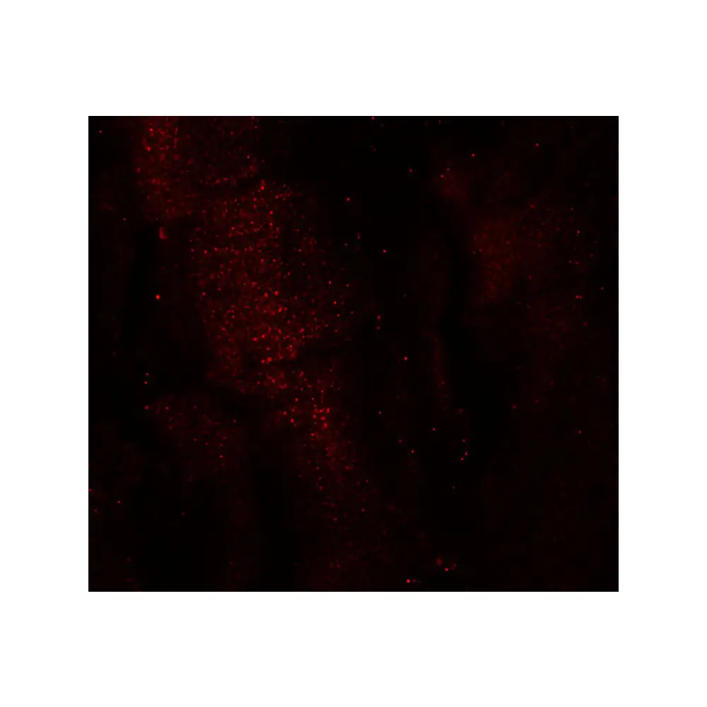 ProSci 6641 RKHD3 Antibody, ProSci, 0.1 mg/Unit Secondary Image