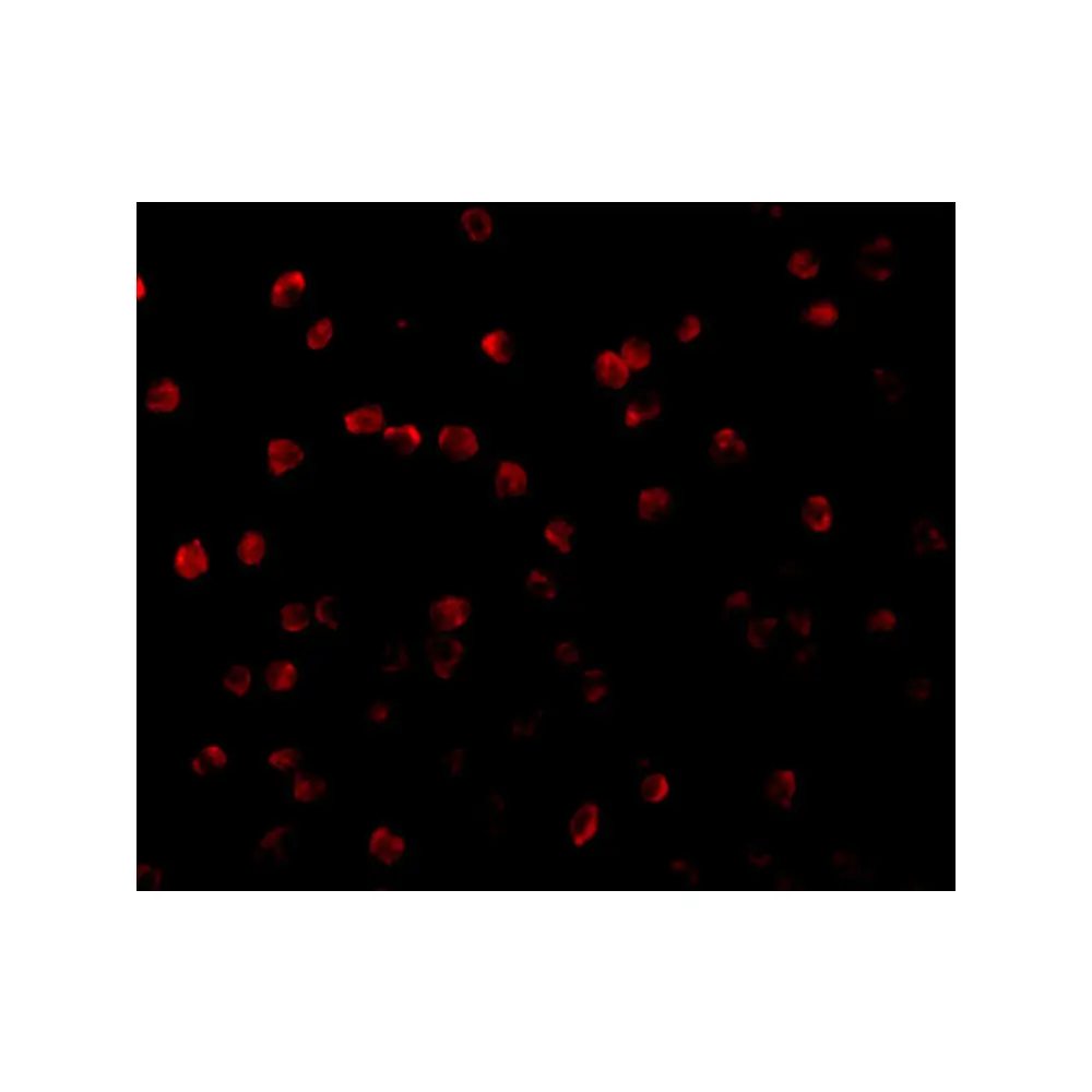 ProSci 3511 RPS6K1 Antibody, ProSci, 0.1 mg/Unit Tertiary Image