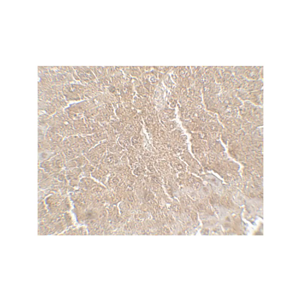 ProSci 7605_S RPSA Antibody, ProSci, 0.02 mg/Unit Secondary Image