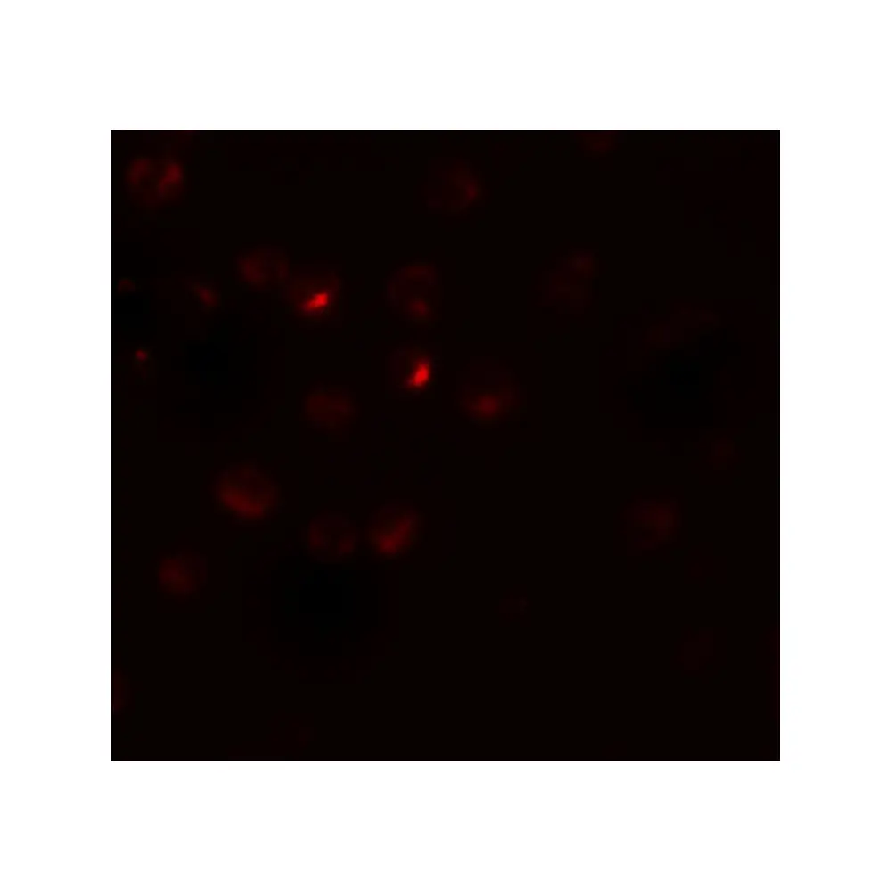 ProSci 8153 RSPO3 Antibody, ProSci, 0.1 mg/Unit Tertiary Image