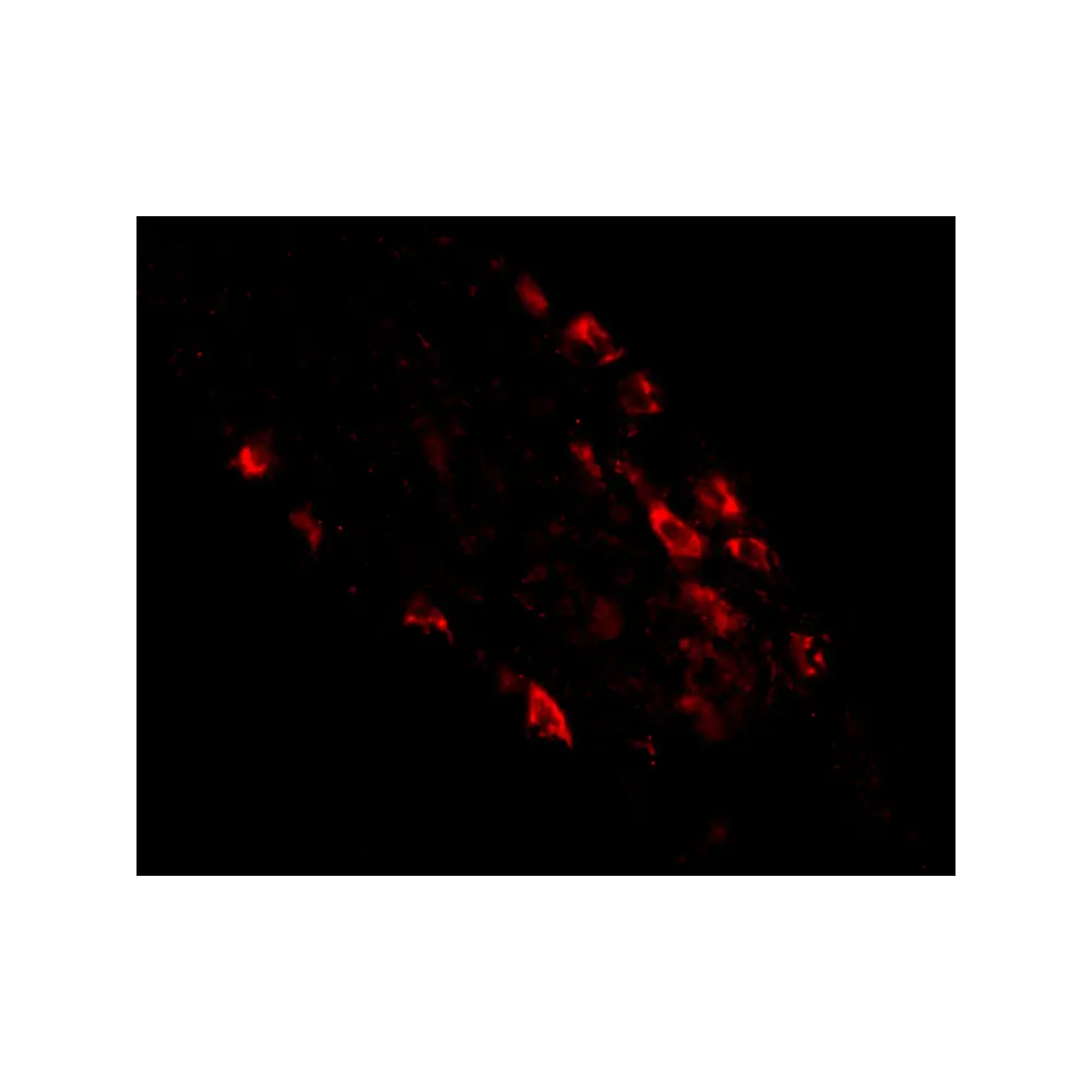 ProSci 4835_S Rkhd1 Antibody, ProSci, 0.02 mg/Unit Tertiary Image