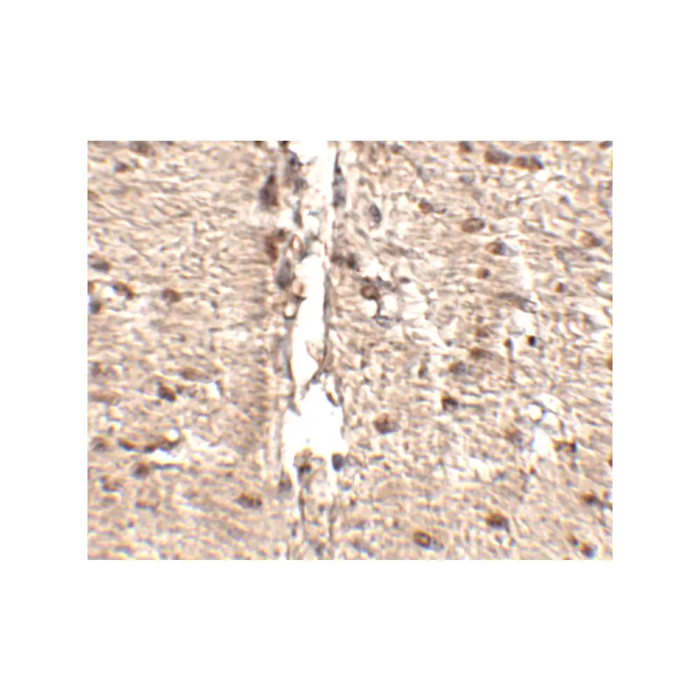 ProSci 4835 Rkhd1 Antibody, ProSci, 0.1 mg/Unit Secondary Image