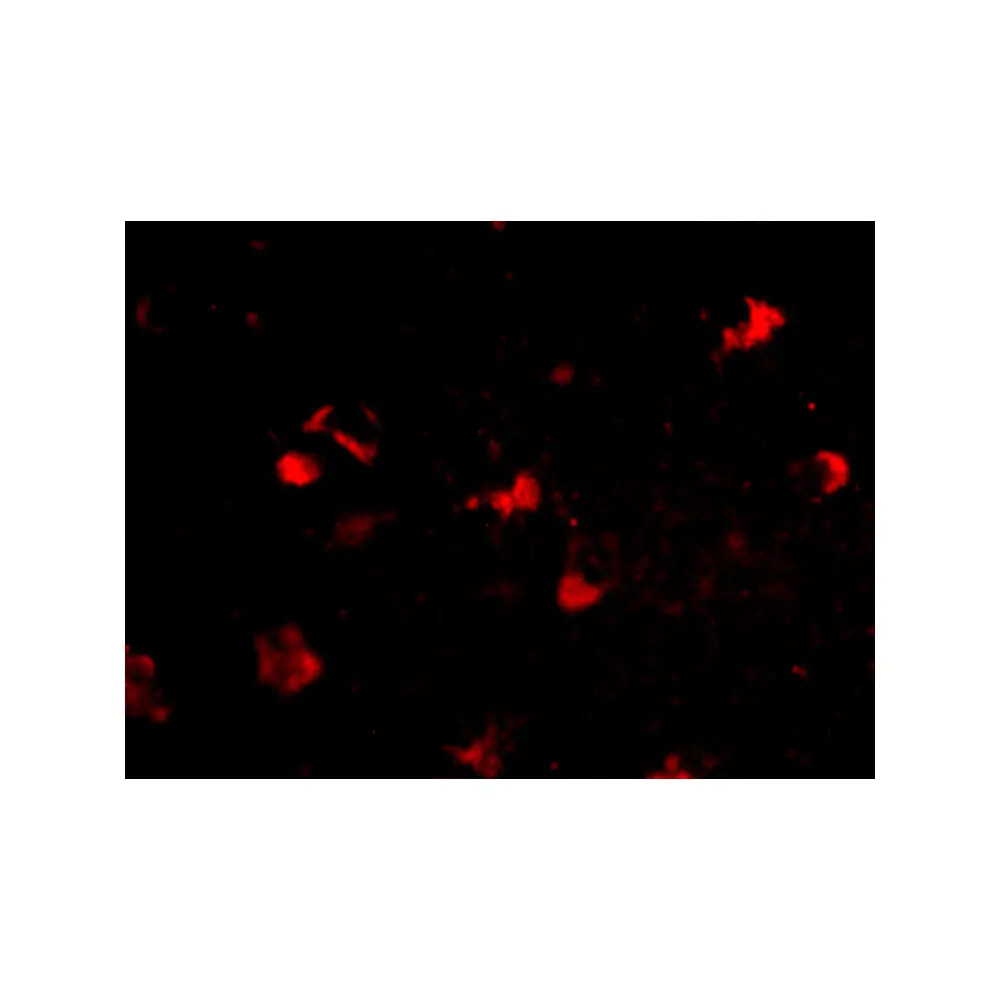ProSci 4869 Rkhd4 Antibody, ProSci, 0.1 mg/Unit Tertiary Image