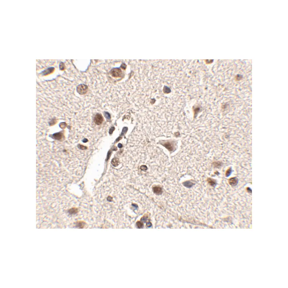 ProSci 4869_S Rkhd4 Antibody, ProSci, 0.02 mg/Unit Secondary Image