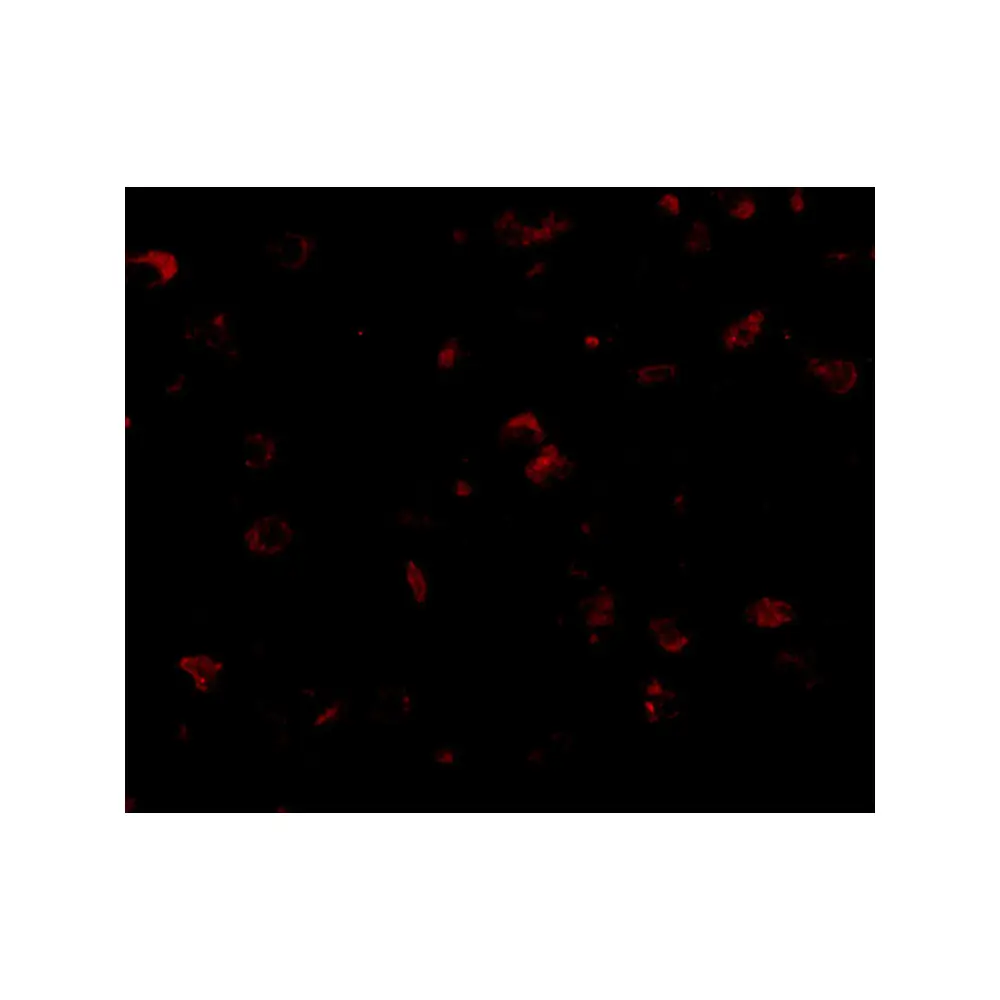 ProSci 4623_S SAPAP1 Antibody, ProSci, 0.02 mg/Unit Tertiary Image