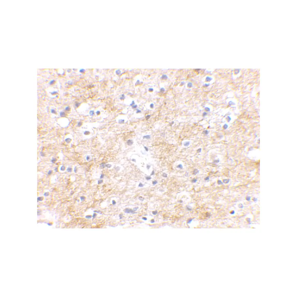 ProSci 4411 SAPAP3 Antibody, ProSci, 0.1 mg/Unit Secondary Image