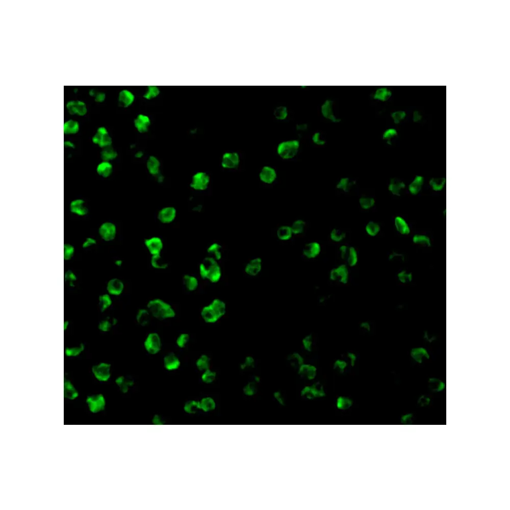 ProSci 3295_S SARM Antibody, ProSci, 0.02 mg/Unit Tertiary Image