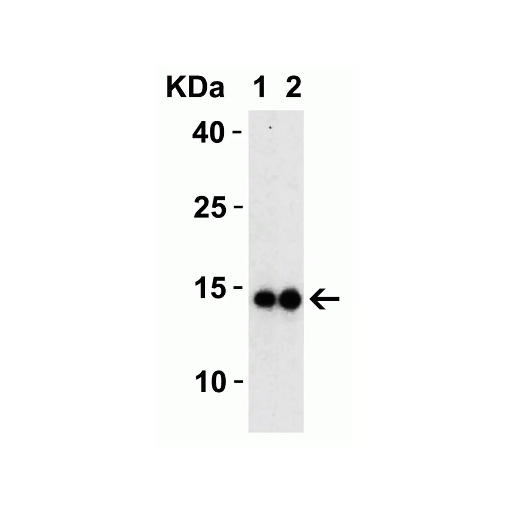 ProSci 9165 SARS-CoV-2 (COVID-19) Membrane Antibody, ProSci, 0.1 mg/Unit Tertiary Image