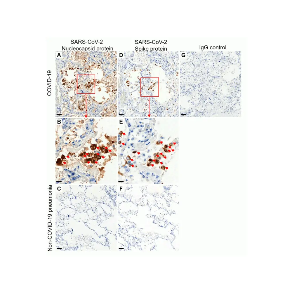 ProSci 9099 SARS-CoV-2 (COVID-19) Nucleocapsid Antibody, ProSci, 0.1 mg/Unit Primary Image
