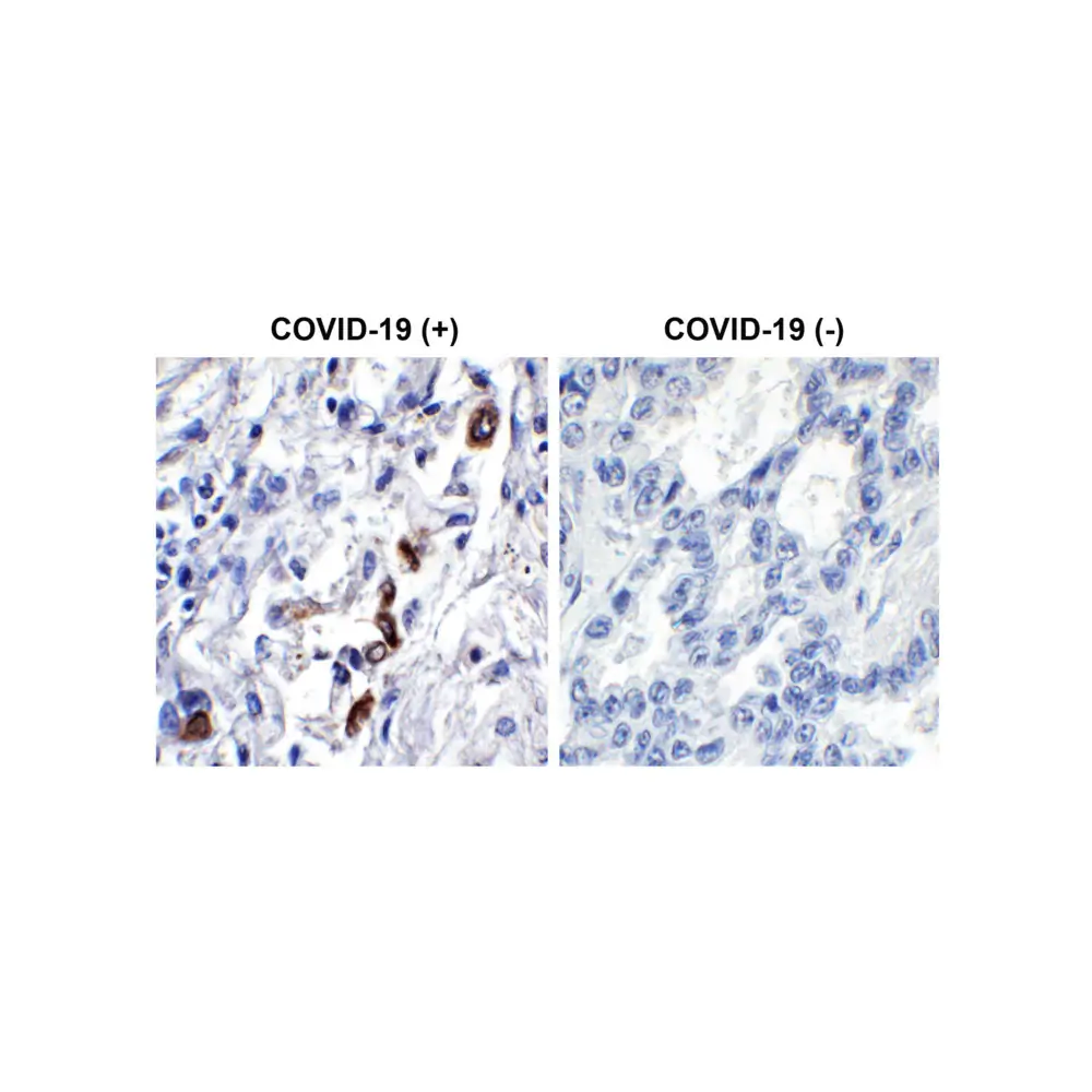 ProSci 9275 SARS-CoV-2 (COVID-19) ORF3a Antibody, ProSci, 0.1 mg/Unit Primary Image