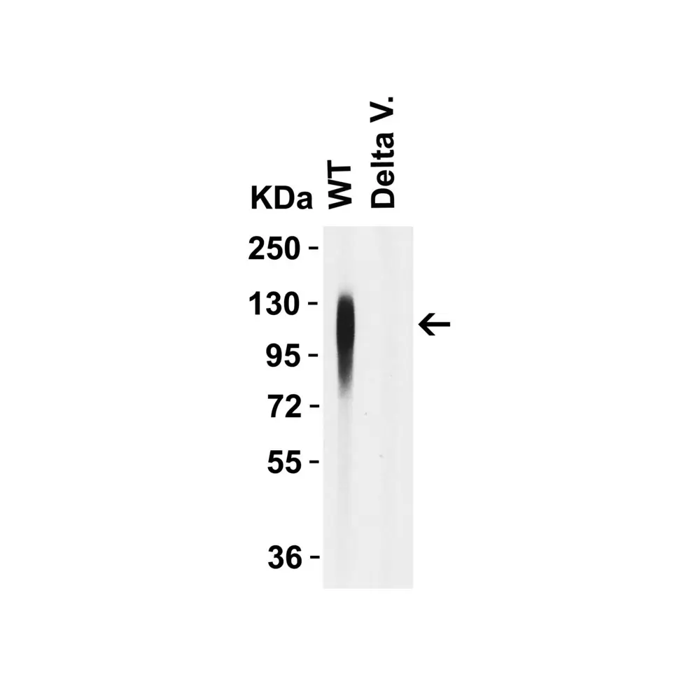 ProSci 9685_S SARS-CoV-2 (COVID-19) Spike 156-157EF Antibody, ProSci, 0.02 mg/Unit Secondary Image