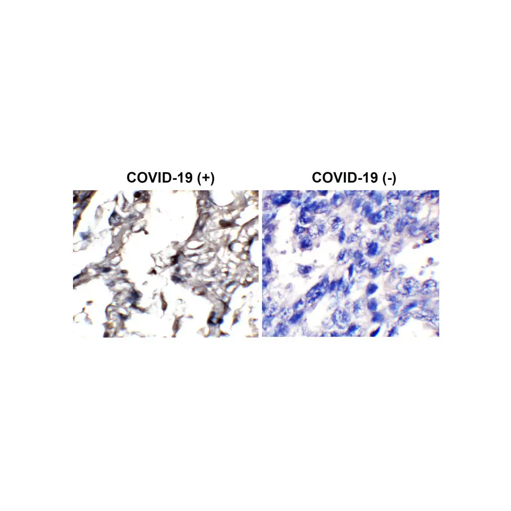 ProSci 3531-biotin_S SARS-CoV-2 (COVID-19) Envelope Antibody (biotin), ProSci, 0.02 mg/Unit Secondary Image