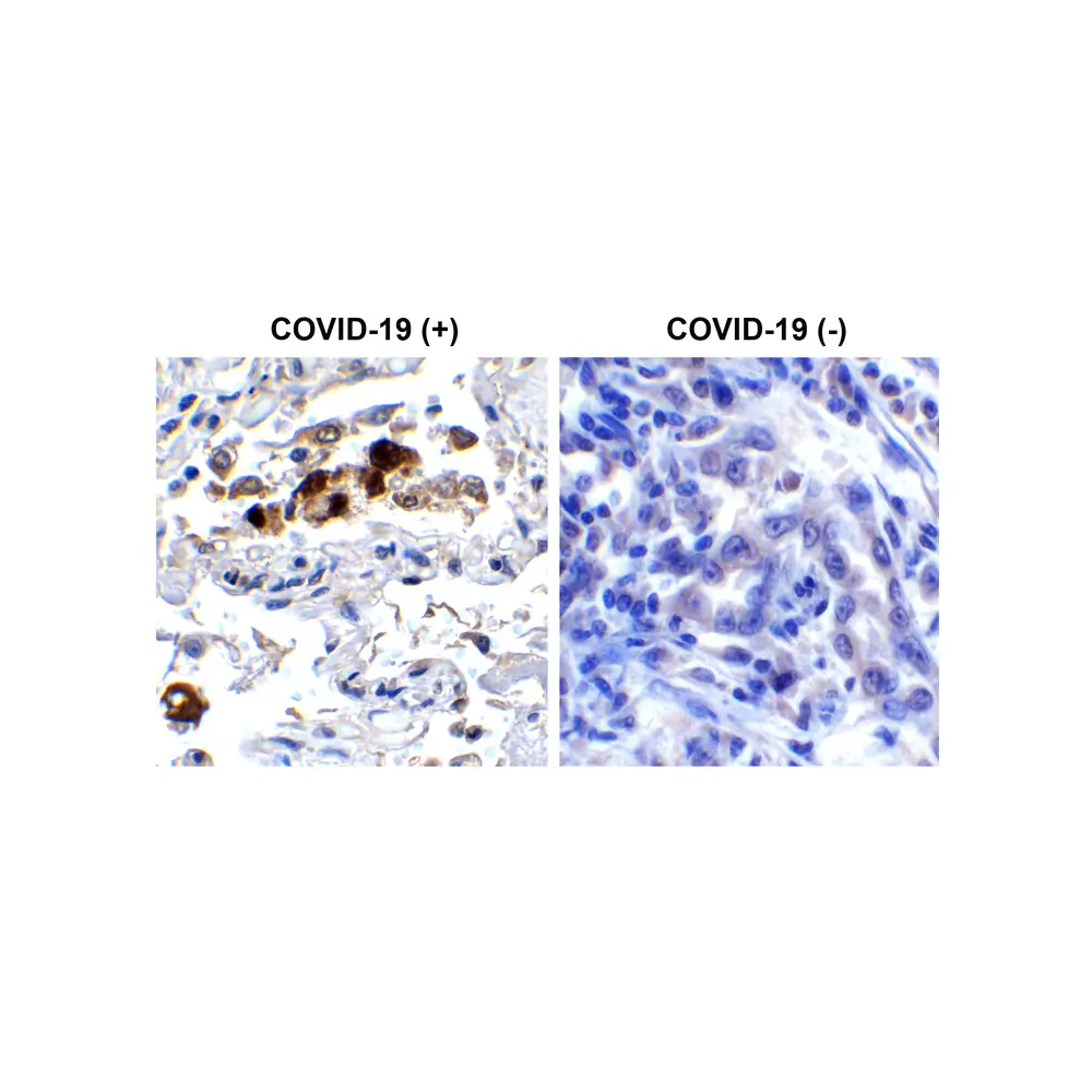 ProSci 9087_S SARS-CoV-2 (COVID-19) Spike RBD Antibody, ProSci, 0.02 mg/Unit Secondary Image