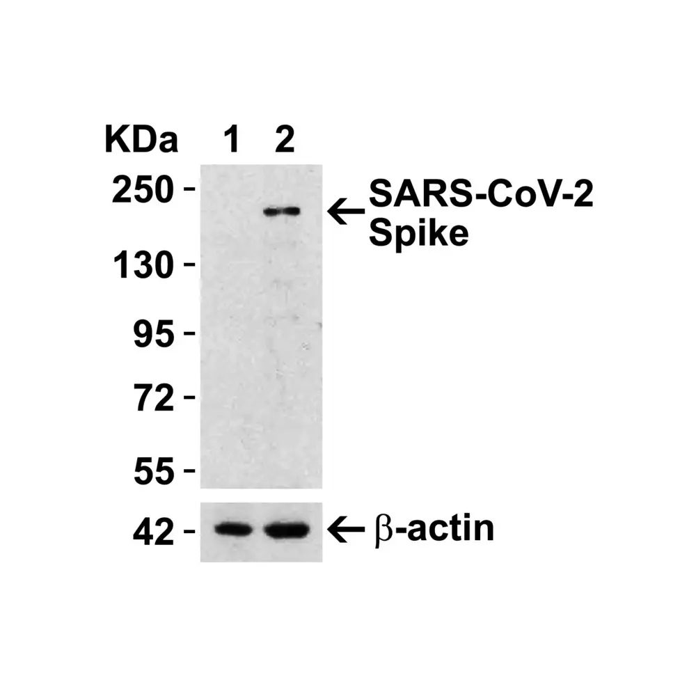 ProSci 9087_S SARS-CoV-2 (COVID-19) Spike RBD Antibody, ProSci, 0.02 mg/Unit Senary Image