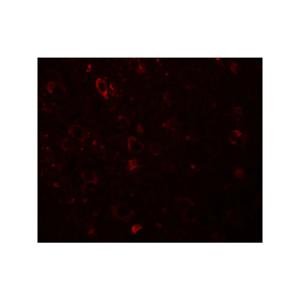 ProSci 5877 SESTD1 Antibody, ProSci, 0.1 mg/Unit Tertiary Image