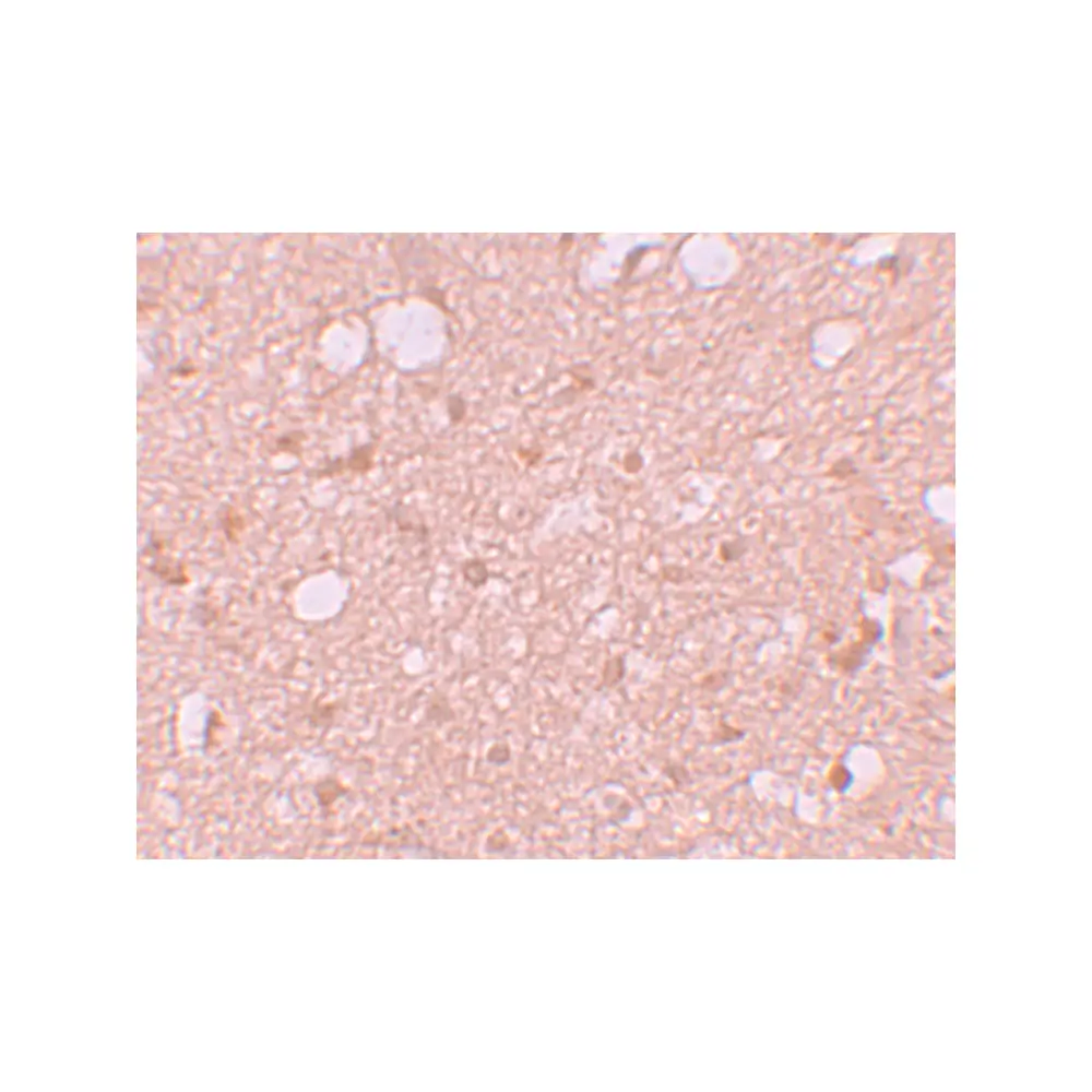 ProSci 5877_S SESTD1 Antibody, ProSci, 0.02 mg/Unit Secondary Image
