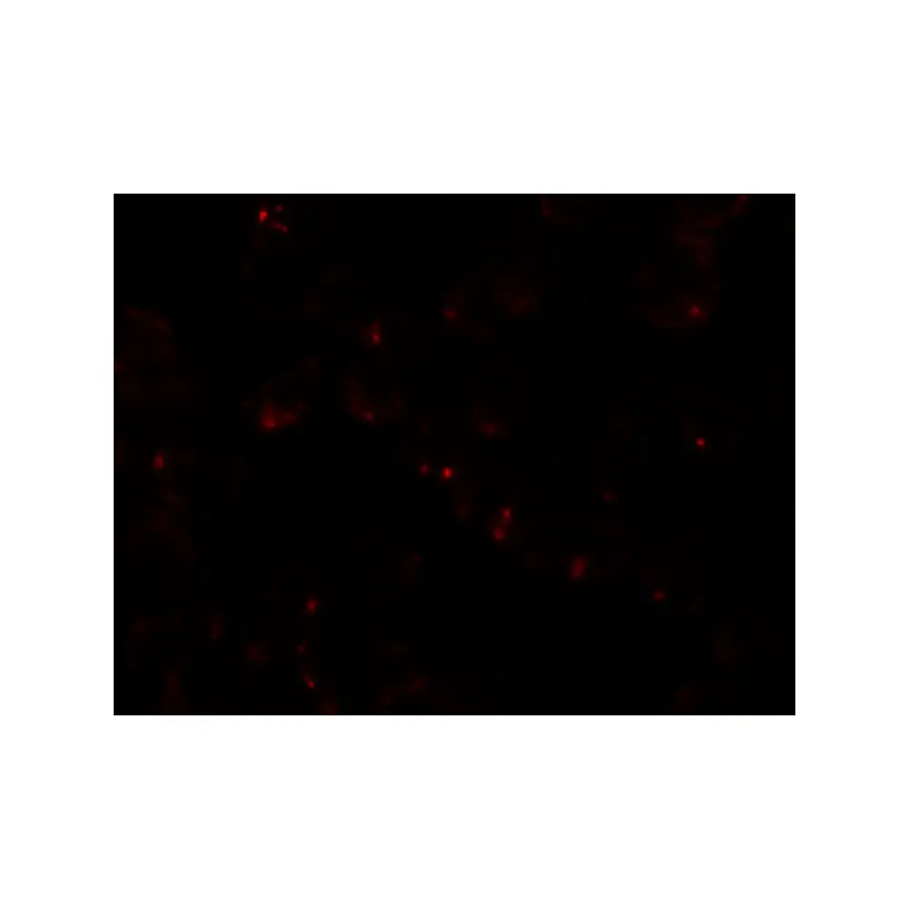 ProSci 6301_S SIK2 Antibody, ProSci, 0.02 mg/Unit Tertiary Image