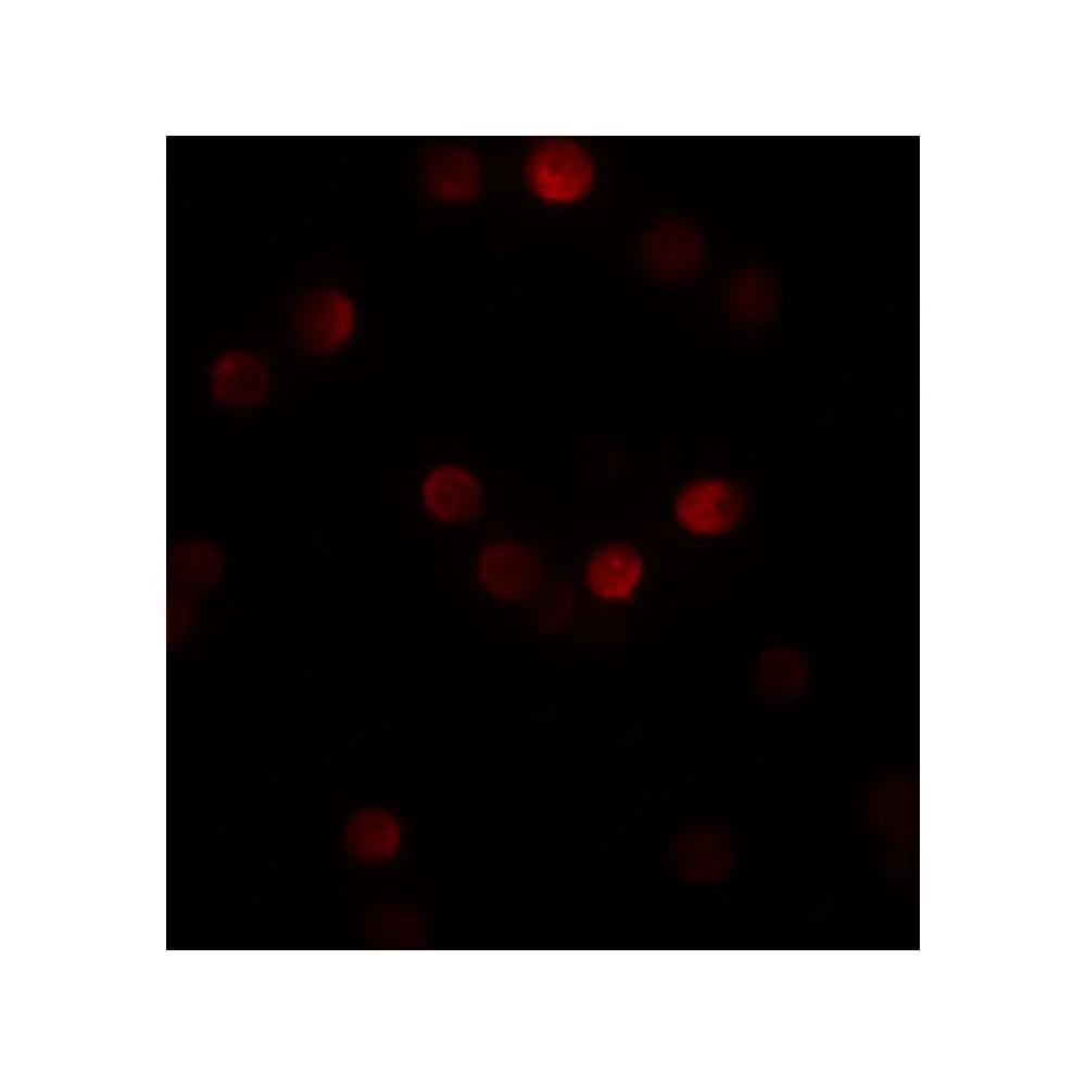ProSci 5823_S SIP1 Antibody, ProSci, 0.02 mg/Unit Tertiary Image