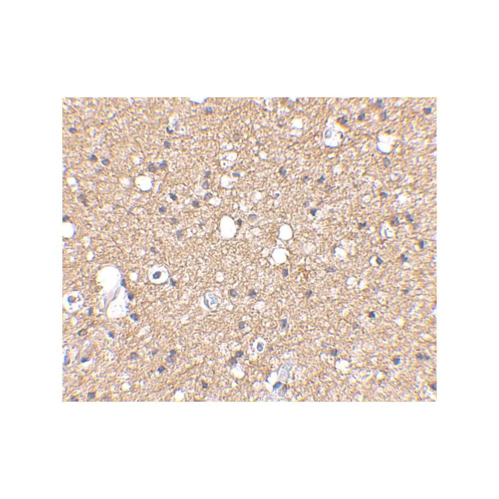 ProSci 4485 SIRT2 Antibody, ProSci, 0.1 mg/Unit Secondary Image